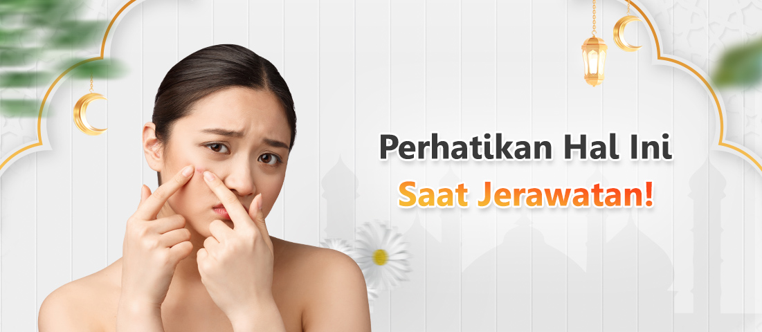 PERHATIKAN HAL INI SAAT JERAWATAN