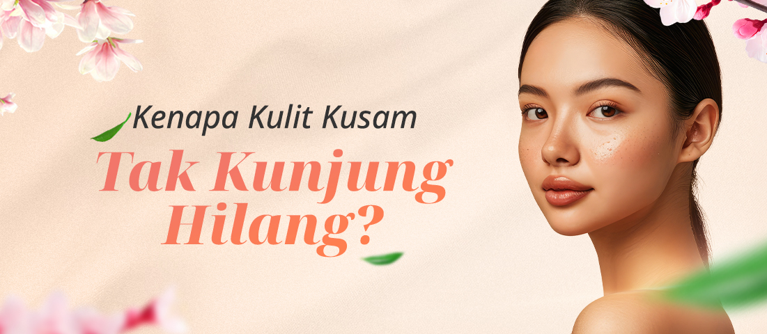 Wajah Masih Kusam Walau Sudah Coba Berbagai Skincare? Mungkin Kamu Butuh Tips Ini!