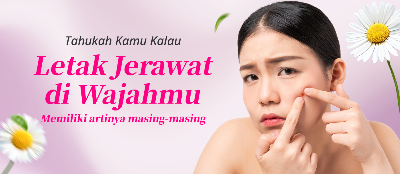 Kenali Jerawat Di Wajahmu & Tips Mengatasinya