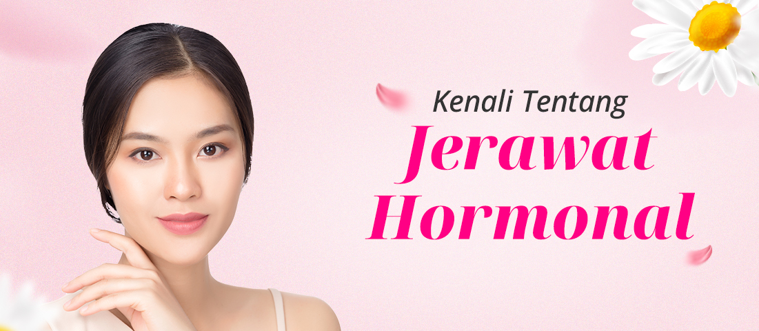 KENALI TENTANG JERAWAT HORMONAL
